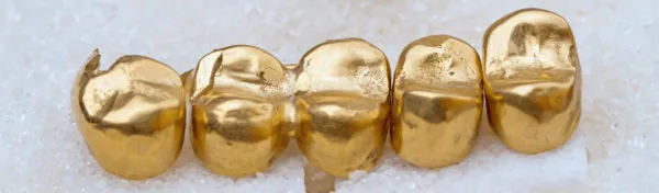 De quoi se compose l’or dentaire ?